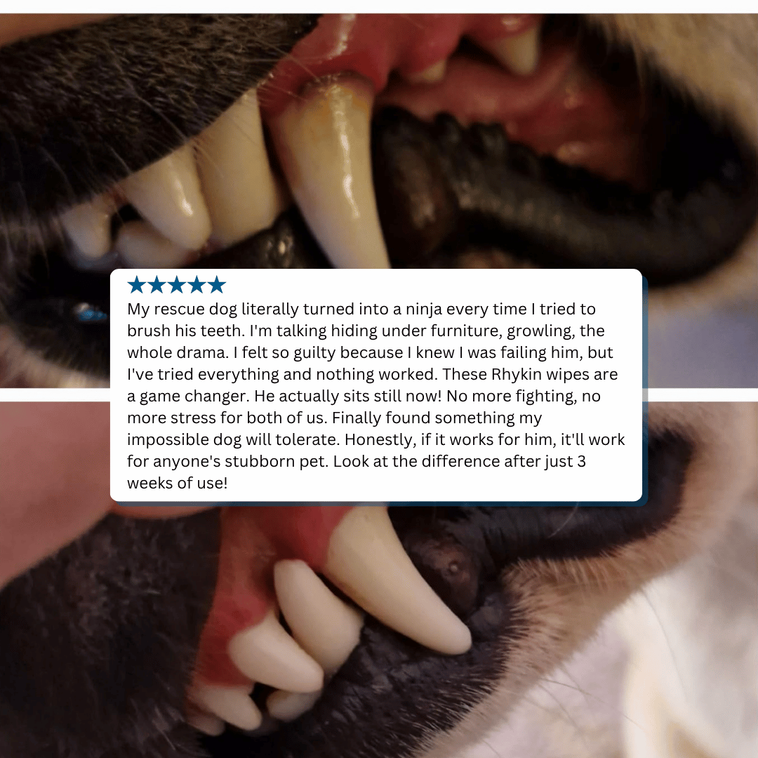 Teeth Cleaning Wipes