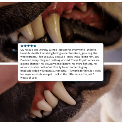 Teeth Cleaning Wipes